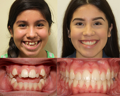 Orthodontics Reston